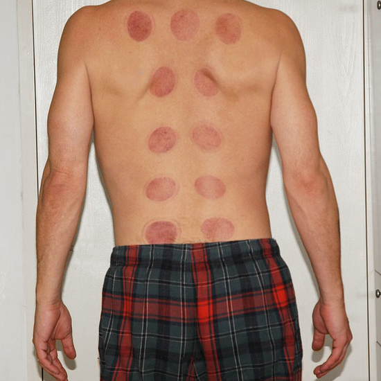 Ne okrećite leđa križobolji! Naučite prepoznati upalnu križobolju!